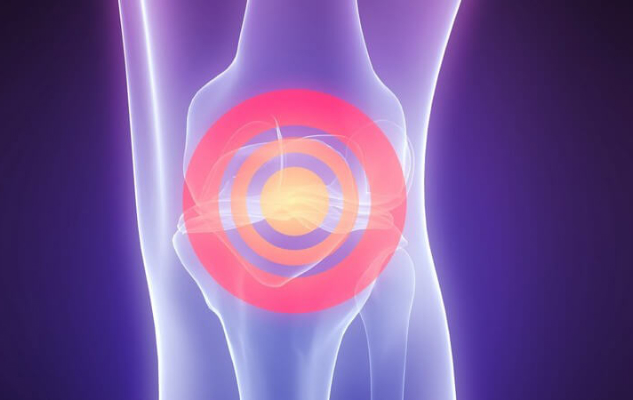 Stem cell therapy: arthrosis is curable!