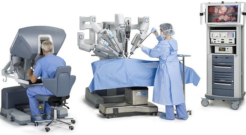 da Vinci surgical system for prostate cancer